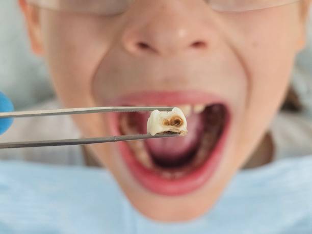 Best Urgent Dental Care for Toothaches in South Fallsburg, NY